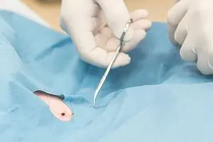 Кодирование от алкоголизма в клинике: методы и способы