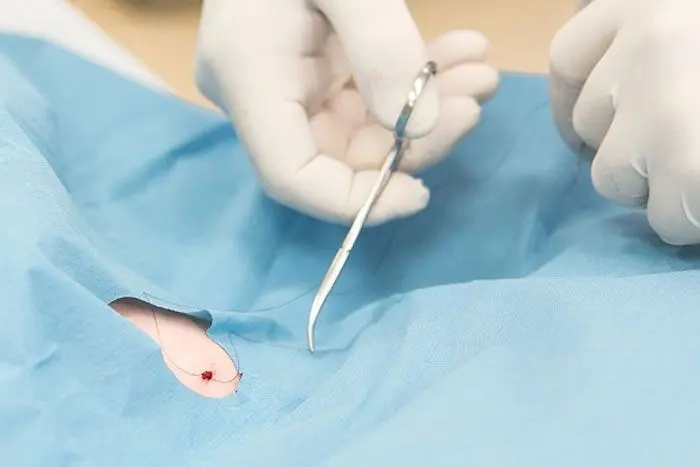 Кодирование от алкоголизма в клинике: методы и способы