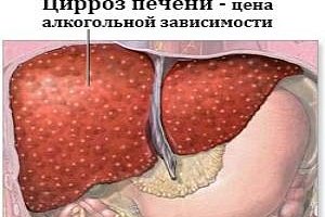 Последствия запоя и лечение